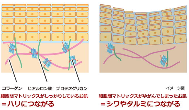 ステップ1 攻める